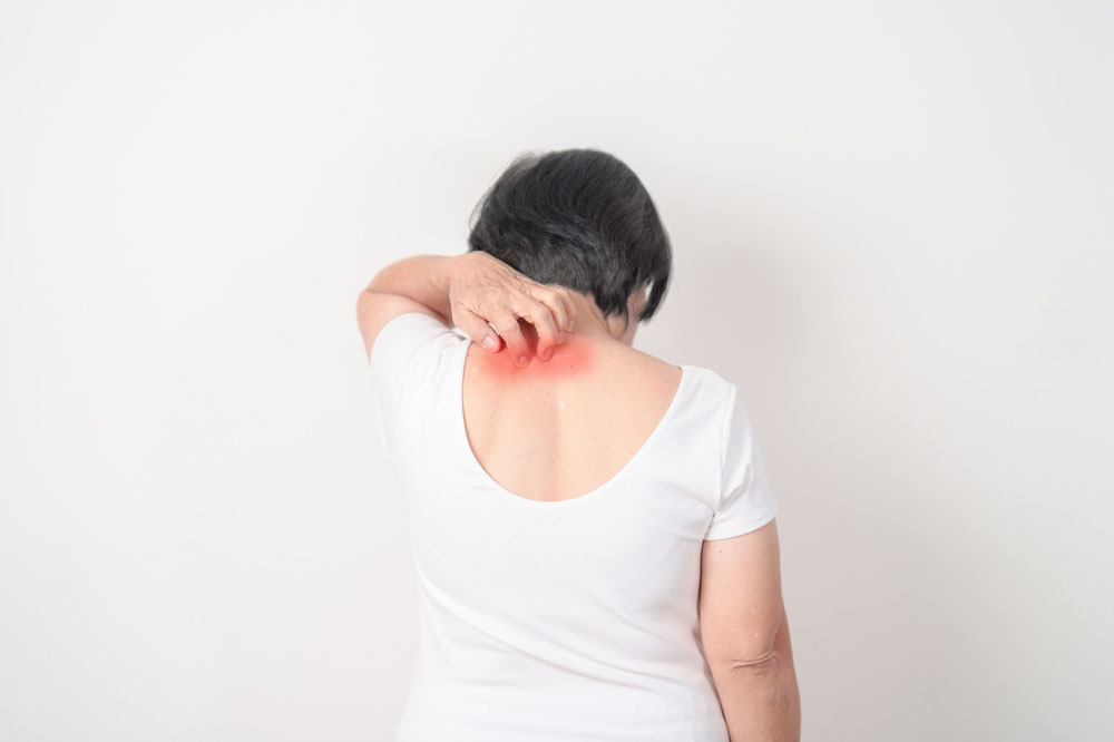 types of dermatology issues